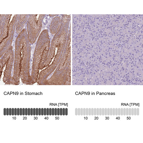 Immunohistochemistry analysis in human stomach and pancreas tissues using HPA020398 antibody. Corresponding CAPN9 RNA-seq data are presented for the same tissues.
