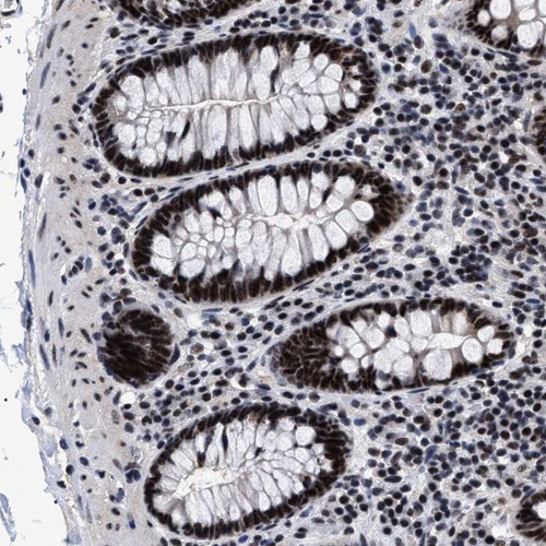 Immunohistochemical staining of human colon shows strong nuclear positivity in glandular cells.