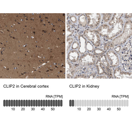 Immunohistochemistry analysis in human cerebral cortex and kidney tissues using Anti-CLIP2 antibody. Corresponding CLIP2 RNA-seq data are presented for the same tissues.