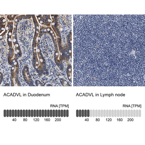 Immunohistochemistry analysis in human duodenum and lymph node tissues using HPA020595 antibody. Corresponding ACADVL RNA-seq data are presented for the same tissues.
