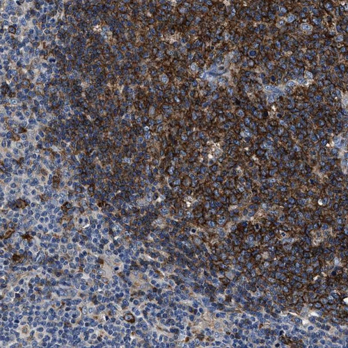 Immunohistochemical staining of human lymph node shows strong cytoplasmic positivity in reaction center cells.