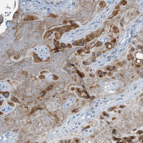 Immunohistochemical staining of human placenta shows strong cytoplasmic positivity in trophoblastic cells.