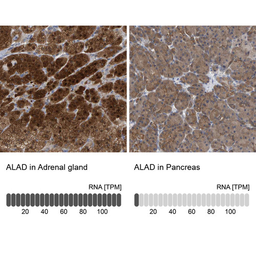 Immunohistochemistry analysis in human adrenal gland and pancreas tissues using Anti-ALAD antibody. Corresponding ALAD RNA-seq data are presented for the same tissues.