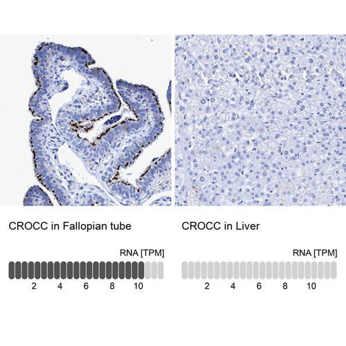 Immunohistochemistry analysis in human fallopian tube and liver tissues using HPA021191 antibody. Corresponding CROCC RNA-seq data are presented for the same tissues.