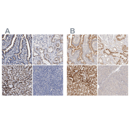 Immunohistochemical staining of human gastrointestinal, kidney, liver and pancreas using Anti-ACOX1 antibody HPA021195 (A) shows similar protein distribution across tissues to independent antibody HPA028759 (B).