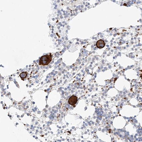 Immunohistochemical staining of human bone marrow shows strong cytoplasmic and membrane positivity in bone marrow poietic cells.