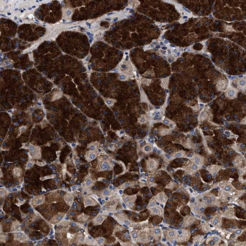 Immunohistochemical staining of human stomach shows strong cytoplasmic positivity in Chief cells.