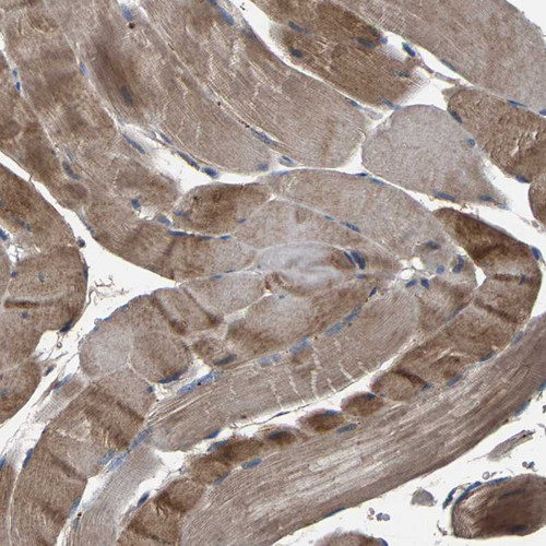Immunohistochemical staining of human skeletal muscle shows  moderate cytoplasmic positivity in myocytes.
