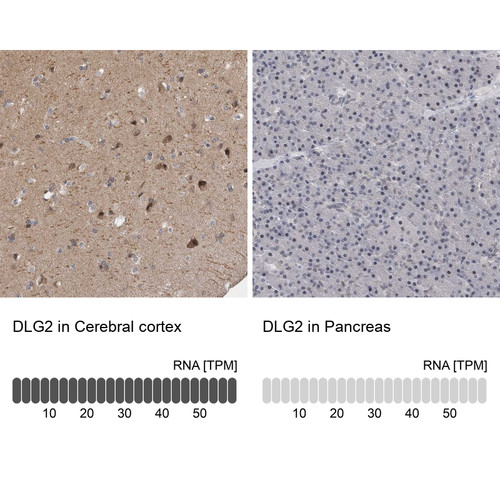 Immunohistochemistry analysis in human cerebral cortex and pancreas tissues using HPA021307 antibody. Corresponding DLG2 RNA-seq data are presented for the same tissues.