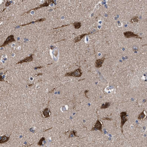 Immunohistochemical staining of human cerebral cortex shows strong cytoplasmic positivity in neuronal cells.