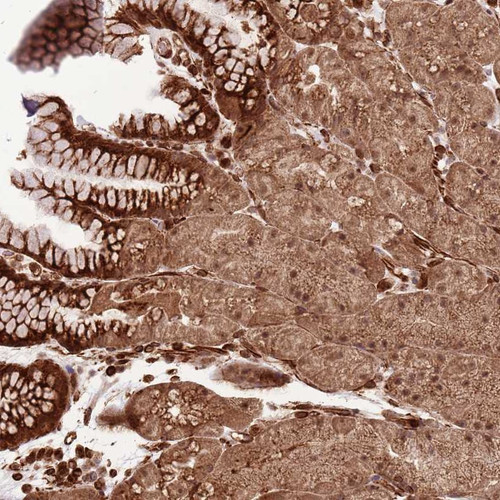 Immunohistochemical staining of human stomach, lower shows strong cytoplasmic and nuclear positivity in glandular cells.