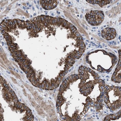 Immunohistochemical staining of human prostate shows strong cytoplasmic and membranous positivity in glandular cells.