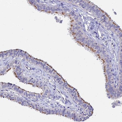 Immunohistochemical staining of human fallopian tube shows moderate cytoplasmic positivity in glandular cells.