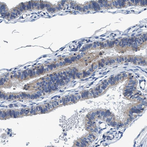 Immunohistochemical staining of human fallopian tube shows cytoplasmic positivity in glandular cells.