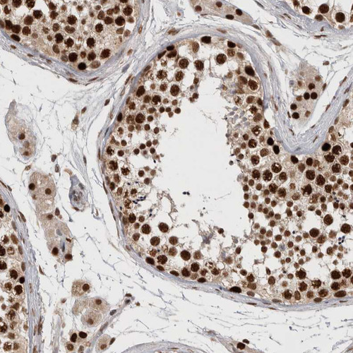 Immunohistochemical staining of human testis shows strong nuclear positivity in cells in seminiferous ducts.