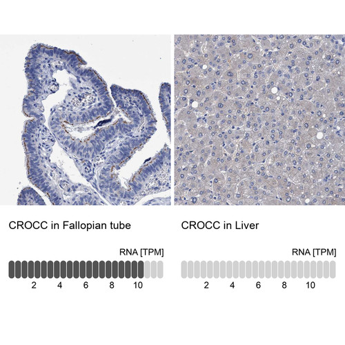 Immunohistochemistry analysis in human fallopian tube and liver tissues using HPA021762 antibody. Corresponding CROCC RNA-seq data are presented for the same tissues.