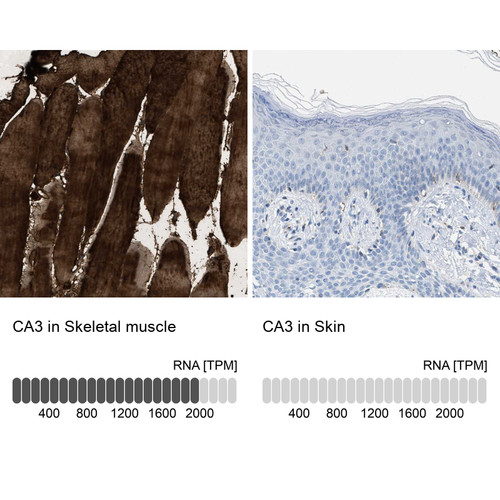 Immunohistochemistry analysis in human skeletal muscle and skin tissues using Anti-CA3 antibody. Corresponding CA3 RNA-seq data are presented for the same tissues.