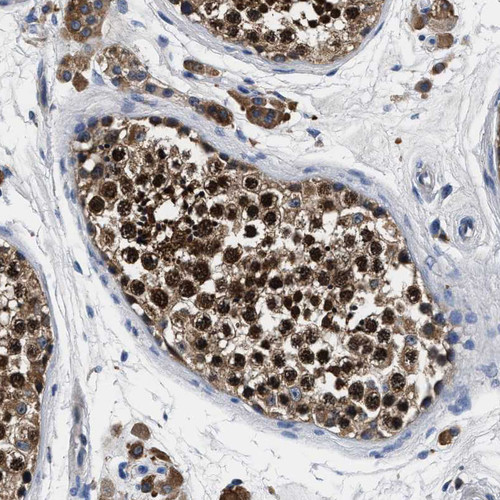 Immunohistochemical staining of human testis shows strong cytoplasmic and nuclear positivity in cells in seminiferous ducts.