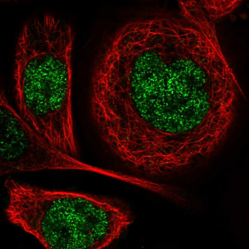 Immunofluorescent staining of human cell line A-431 shows localization to nucleoplasm.
