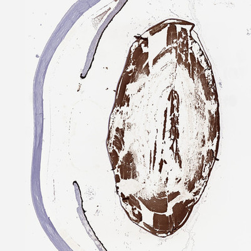 Immunohistochemical staining of human eye shows strong positivity in lens.