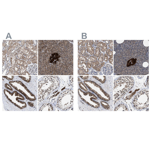 Immunohistochemical staining of human kidney, pancreas, prostate and testis using Anti-ACLY antibody HPA022434 (A) shows similar protein distribution across tissues to independent antibody HPA022953 (B).