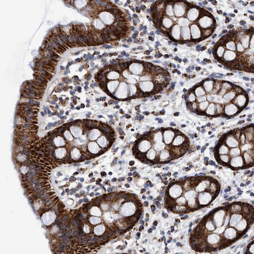 Immunohistochemical staining of human rectum shows strong cytoplasmic positivity with a granular pattern in glandular cells.