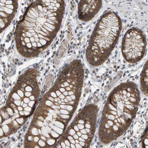 Immunohistochemical staining of human colon shows moderate cytoplasmic positivity in glandular cells.