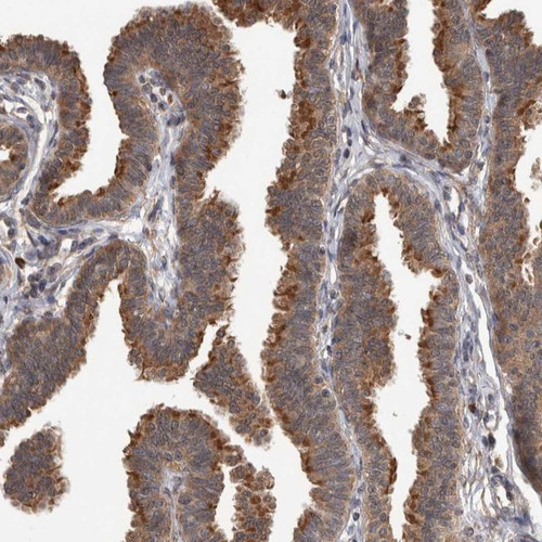 Immunohistochemical staining of human fallopian tube shows strong cytoplasmic positivity in glandular cells.