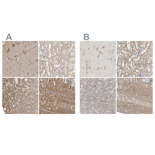 Immunohistochemical staining of human cerebral cortex, kidney, liver and skeletal muscle using Anti-DCAF7 antibody HPA022948 (A) shows similar protein distribution across tissues to independent antibody HPA022962 (B).