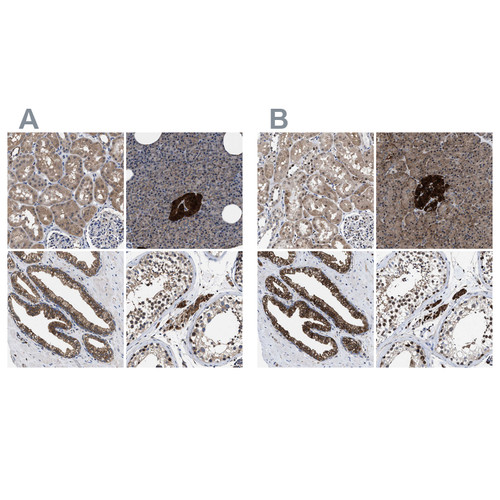 Immunohistochemical staining of human kidney, pancreas, prostate and testis using Anti-ACLY antibody HPA022953 (A) shows similar protein distribution across tissues to independent antibody HPA022434 (B).