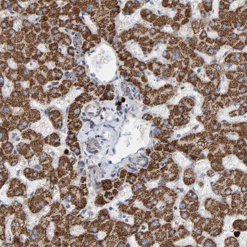 Immunohistochemical staining of human liver shows strong cytoplasmic positivity with a granular pattern in hepatocytes.