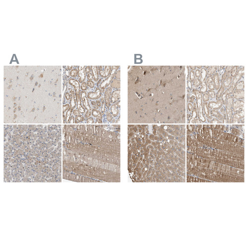 Immunohistochemical staining of human cerebral cortex, kidney, liver and skeletal muscle using Anti-DCAF7 antibody HPA022962 (A) shows similar protein distribution across tissues to independent antibody HPA022948 (B).