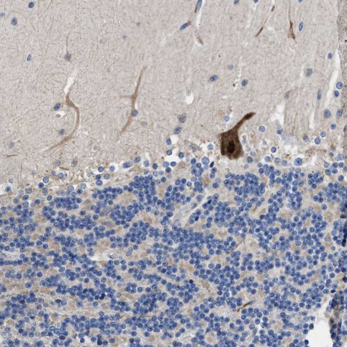 Immunohistochemical staining of human cerebellum shows strong nuclear and cytoplasmic positivity in purkinje cells.
