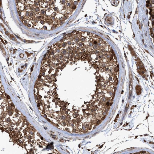 Immunohistochemical staining of human testis shows distinct cytoplasmic positivity in cells of ductus seminiferus.