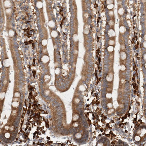 Immunohistochemical staining of human duodenum shows strong cytoplasmic positivity in lymphoid cells.