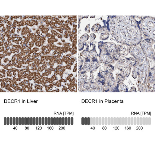Immunohistochemistry analysis in human liver and placenta tissues using Anti-DECR1 antibody. Corresponding DECR1 RNA-seq data are presented for the same tissues.