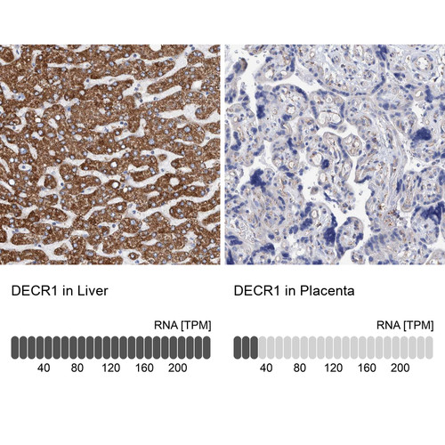 Immunohistochemistry analysis in human liver and placenta tissues using Anti-DECR1 antibody. Corresponding DECR1 RNA-seq data are presented for the same tissues.