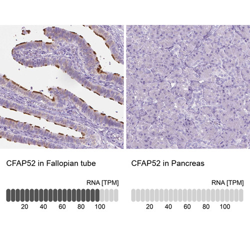 Immunohistochemistry analysis in human fallopian tube and pancreas tissues using HPA023247 antibody. Corresponding CFAP52 RNA-seq data are presented for the same tissues.