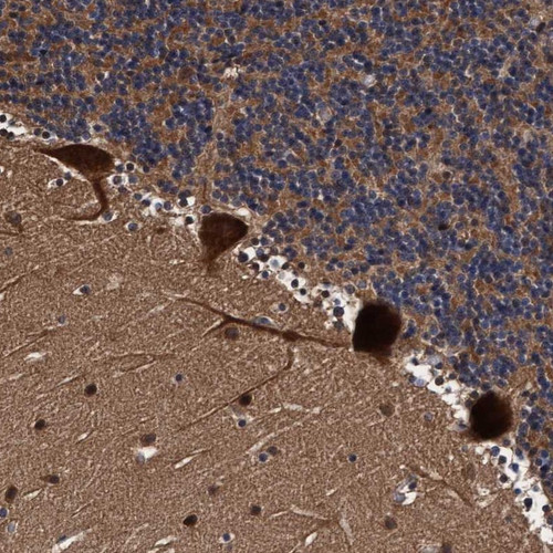Immunohistochemical staining of human cerebellum shows strong cytoplasmic positivity in purkinje cells.