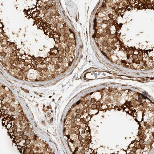 Immunohistochemical staining of human testis shows strong cytoplasmic positivity in Leydig cells and cells in seminiferous ducts.