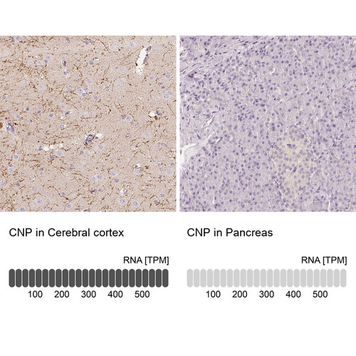 Immunohistochemistry analysis in human cerebral cortex and pancreas tissues using Anti-CNP antibody. Corresponding CNP RNA-seq data are presented for the same tissues.