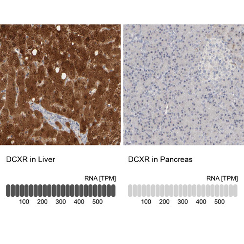 Immunohistochemistry analysis in human liver and pancreas tissues using Anti-DCXR antibody. Corresponding DCXR RNA-seq data are presented for the same tissues.