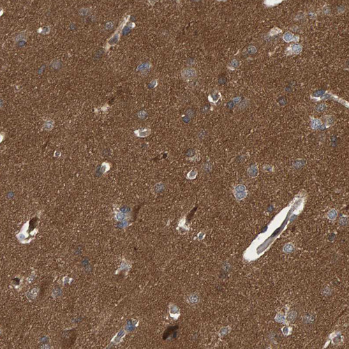 Immunohistochemical staining of human cerebral cortex shows strong cytoplasmic positivity in neuropil.