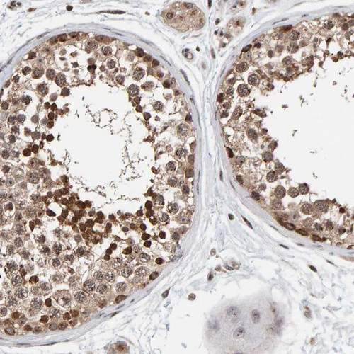 Immunohistochemical staining of human testis shows nuclear positivity in cells of seminiferous ducts.