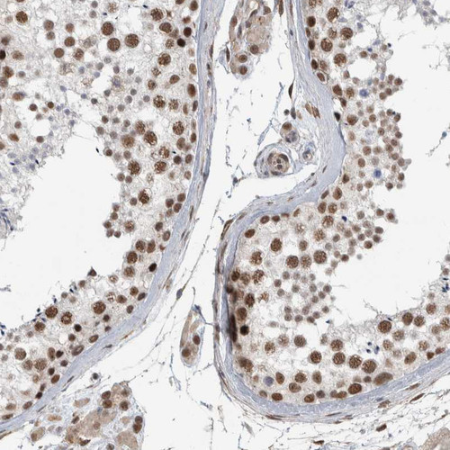 Immunohistochemical staining of human testis shows moderate nuclear positivity in cells in seminiferous ducts.