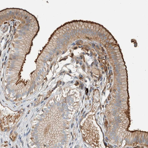 Immunohistochemical staining of human gall bladder shows distinct membranous and cytoplasmic positivity in glandular cells.
