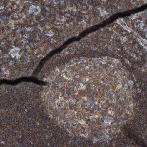 Immunohistochemical staining of human tonsil shows moderate positivity in reaction center cells while cells outside the reaction center were strongly positive.