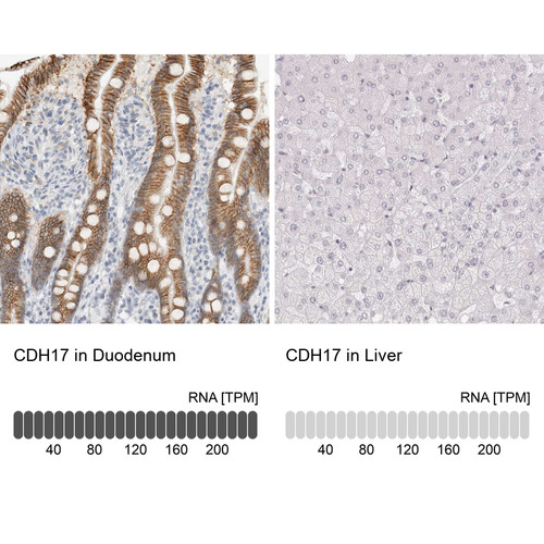 Immunohistochemistry analysis in human duodenum and liver tissues using HPA023614 antibody. Corresponding CDH17 RNA-seq data are presented for the same tissues.