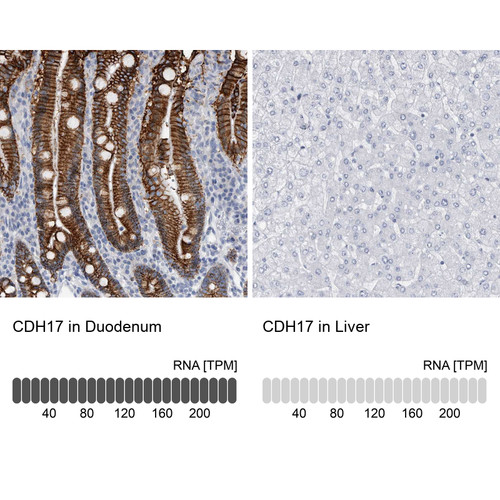 Immunohistochemistry analysis in human duodenum and liver tissues using HPA023616 antibody. Corresponding CDH17 RNA-seq data are presented for the same tissues.