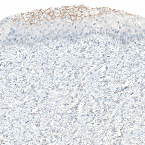Immunohistochemical staining of human cervix, uterine shows membranous positivity in squamous epithelial cells.